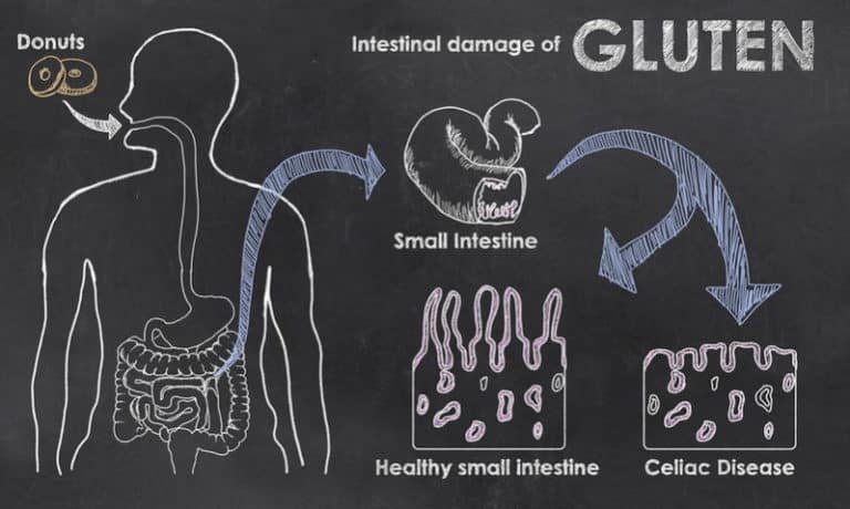 Gluten Intolerance After GI Infections