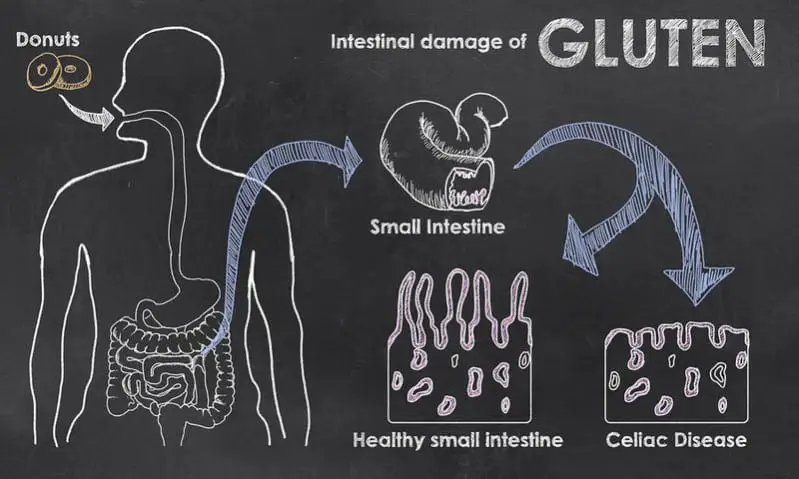 Intestinal Damage Gluten e1430493176743